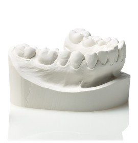 Elite Model Fast - 25кг.