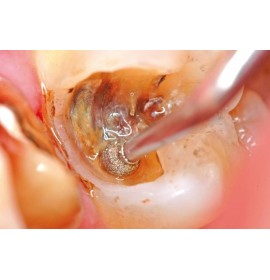 Интраорална Камера SOPRO 717 First 