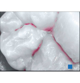 Интраорална Камера SOPROCARE