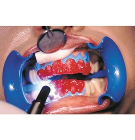 Bleach`n Smile Automix Set - Избелваща система